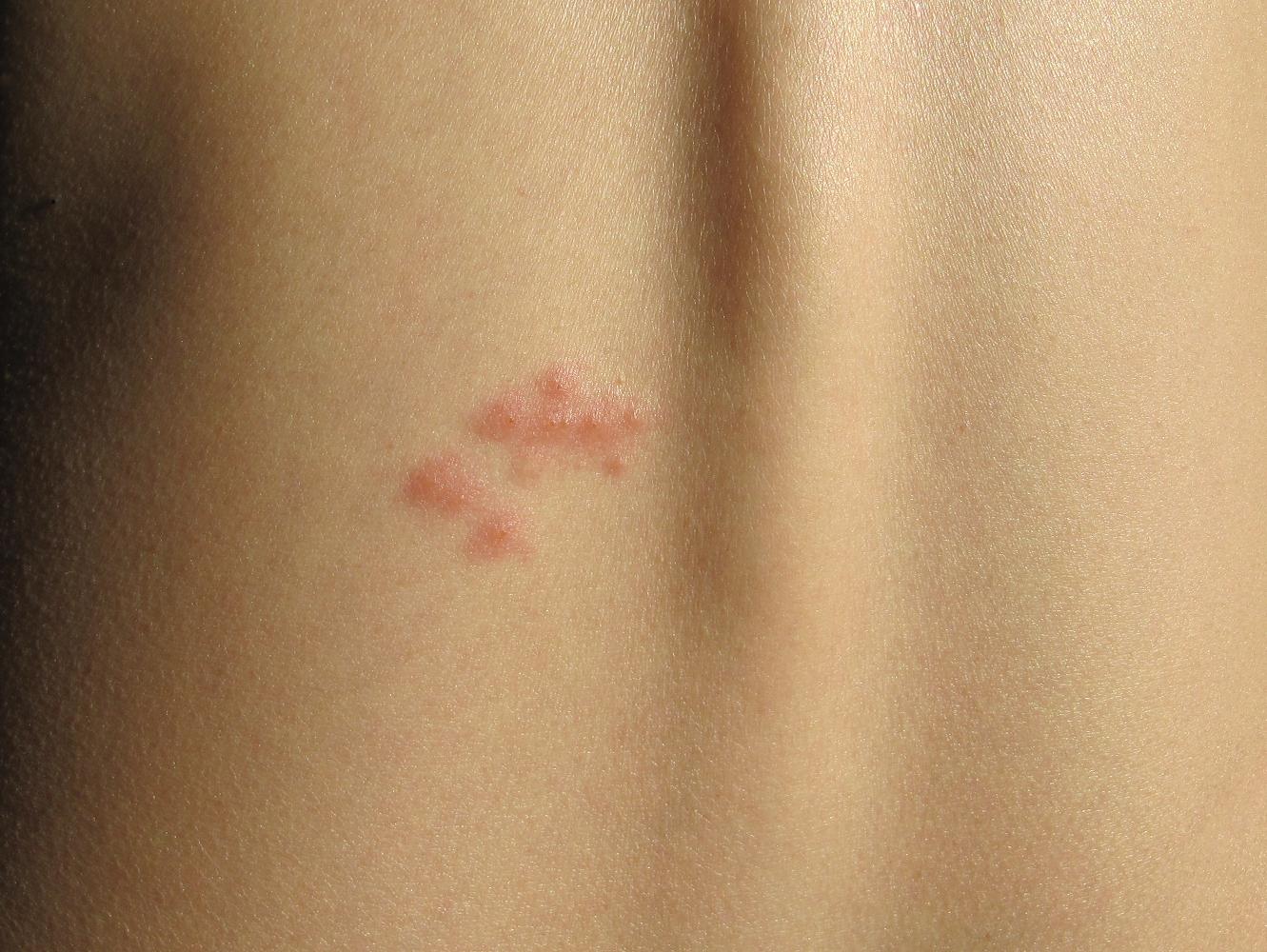 充血した顔の原因は何ですか?