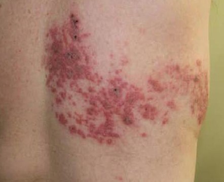 皮膚科専門医の往診を希望の方は、まずは地域連携室にご連絡ください。